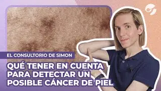 C&oacute;mo REVISAR tus LUNARES para identificar potenciales MELANOMAS | Por @SimonScaranoDermatologo