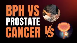 BPH vs Prostate Cancer: Understanding the Key Differences