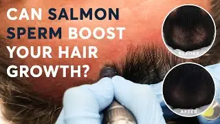 Can Salmon Sperm Boost Your Hair Growth?