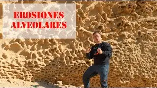 Erosiones alveolares
