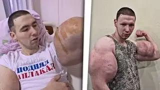 PELIGRA LA VIDA DEL POPEYE RUSO CON BRAZOS DE SYNTHOL (&iacute;dolo de El Rinc&oacute;n de Giorgio)