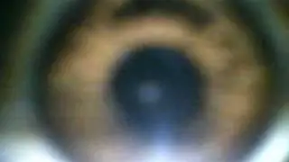 eye lance react in light