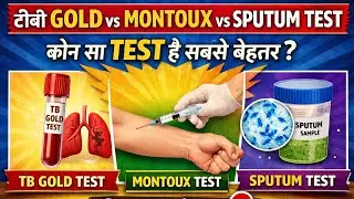 TB Pakadne Ka Sabse Sahi Test Kaunsa Hai? | TB Gold Test vs Montoux vs Sputum | TB Test Comparison