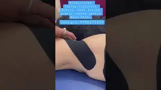 घुटना सीधा करने में दर्द !Overfiring Popliteal. @vitalityphysiotherapyosteo1945