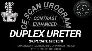 CECT Scan Urogram to rule out Renal Pathology