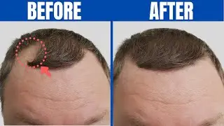 FOODS FOR HAIR GROWTH - 12 Healthy Hair Foods You Should Start Eating Every Day!