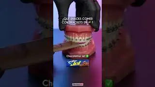 &iquest;Que comer con brackets en 🇨🇴 ? - Odontolog&iacute;a L&aacute;ser #Shorts
