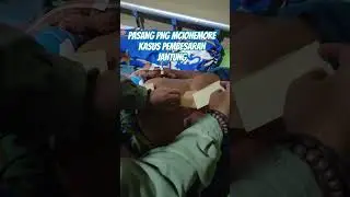 cara pasang png mcionemore pada kasus pembesaran jantung..cuman 3 hari opname #transdermalpatch