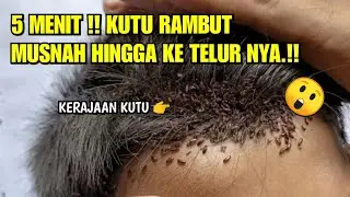 BASMI HABIS KERAJAAN KUTU DENGAN RACIKAN ALAMI PEMBASMI INI