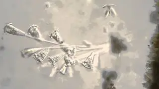 zoothamnium