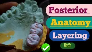 Posterior Anatomy Layering|| Metal ceramic| dental technician| ceramic build up| ceramic layering