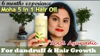 Moha Herbal Anti Dandruff Hair Oil Review | Tried & Tested Hair Oil for Dandruff & Hair Growth