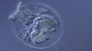 Rotifer: Testudinella patina