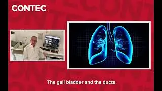 German Medical Experts used and recommended the CONTEC CMS1700 Colour Doppler Ultrasound.