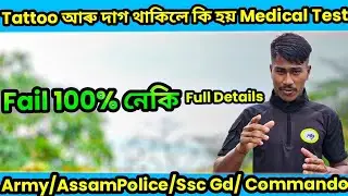 😥Tattoo আৰু দাগ থাকিলে কি হব 😱!!  Assam police/Army/Ssc Gd /Commando 🔥