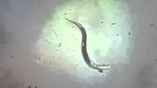 Watch a Strongyle Worm in Action