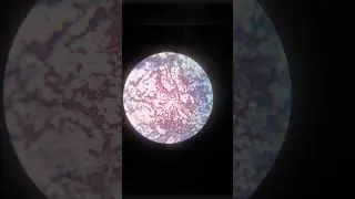 Gram positive# bacteria#Staphylococcus aureus#cocci#Gram staining#microscopic view