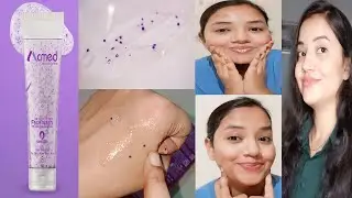Acmed Facewash Review+Demo|Best facewash For Oily Acne/Pimples Prone Skin|Oily Skin summer Facewash