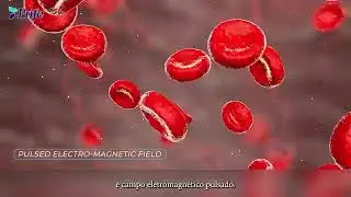 Aparelho para os p&eacute;s: Itera Bio Lite 