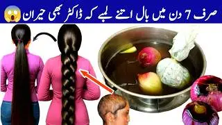How to Use Onion For 10x Faster Thicker Hair Growth!!😱 | 100 DIY Onion Oil for Extreme Hairgrowth💯
