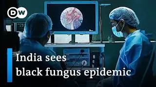 Why the deadly black fungus is ravaging COVID patients in India | DW News