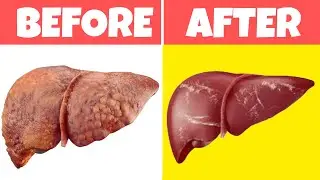 Your Inner Detox Champion | Top 12 Liver-Loving Superfoods | Healthy You