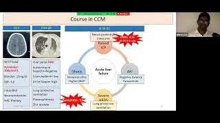 Tropical Infection in ICU, Prof  & Head  Dr  Banani Poddar, Dr  Shreyas, Department of CCM, SGPGIMS