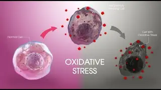 Oxidative stress and Fibromyalgia