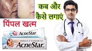 Acnestar gel HONEST review in  hindi | Acnestar gel results, benefits, uses, price info.