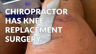 Dr Warwick Recovers from Knee Replacement Surgery