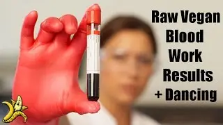 Long Term Raw Vegan Blood work Results n Charlize fun - Chris Kendall The Raw Advantage