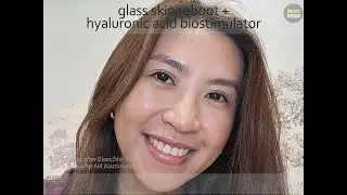 Glass Skin Reboot for the Perfect Glow-Up!