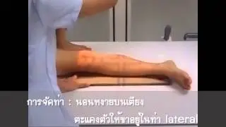 Leg : Lateral (Mediolateral)