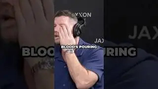 How Bisping Lost His Eye in the UFC 👁️💥