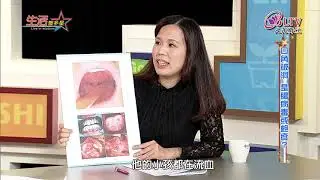 生活智多星 第421集－口角破洞 是腸病毒或疱疹？