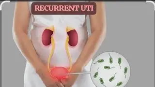 URINARY TRACT INFECTIONS#RECURRENT UTI IN WOMEN.