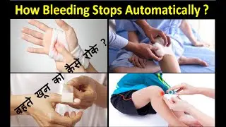 How Bleeding Stop & Precautions to be taken |चोट लगने पर खून कैसे बंद होता है |चोट लगने पर सावधानिया