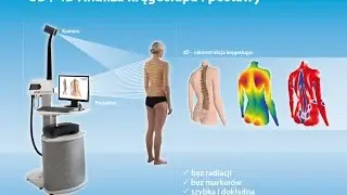 DIERS - badanie kręgosłupa, diagnostyka skolioz
