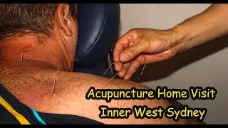 Acupuncture Home Visit Inner West Sydney