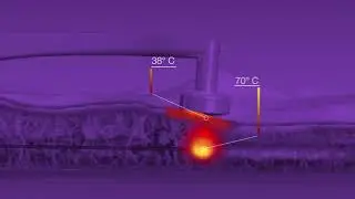 BodyTite Animation by InMode