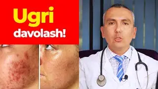 Ugri(husnbuzar) qanday davolanadi? Komentariyalarga javob #6