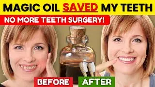 AVOID ORAL SURGERY: Heal Your TEETH With CASTOR OIL (7 Days)