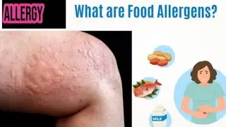 food allergy information |Auto Doctor's guide 