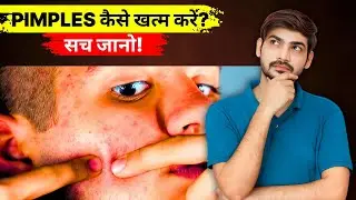 Types of Pimples - Forehead, Nose Area ke Pimples ko Kaise Treat Kare? Causes & Reasons Behind Acne