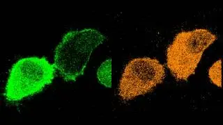 Comparison of delocalization of a mutant and wild-type PKC gamma