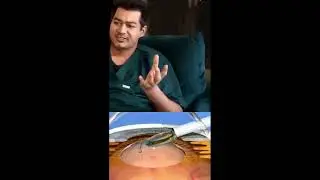 ICL Lens: The Most Advanced Technology for Vision Correction | Benefits, Procedure & Cost