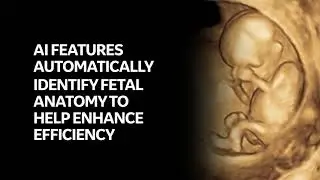 Innovation in Ultrasound