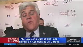 Jay Leno burned in car fire at Burbank garage: Report