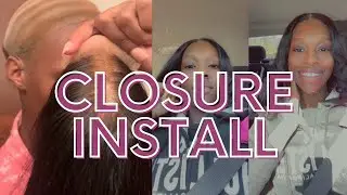 4x4 Closure Wig Install | Amazon Wig