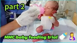 Part 2: MMC Baby Feeding Trial 🍼 | Condition Improving in NICU Care #feedingtrial #Myelomeningocele
